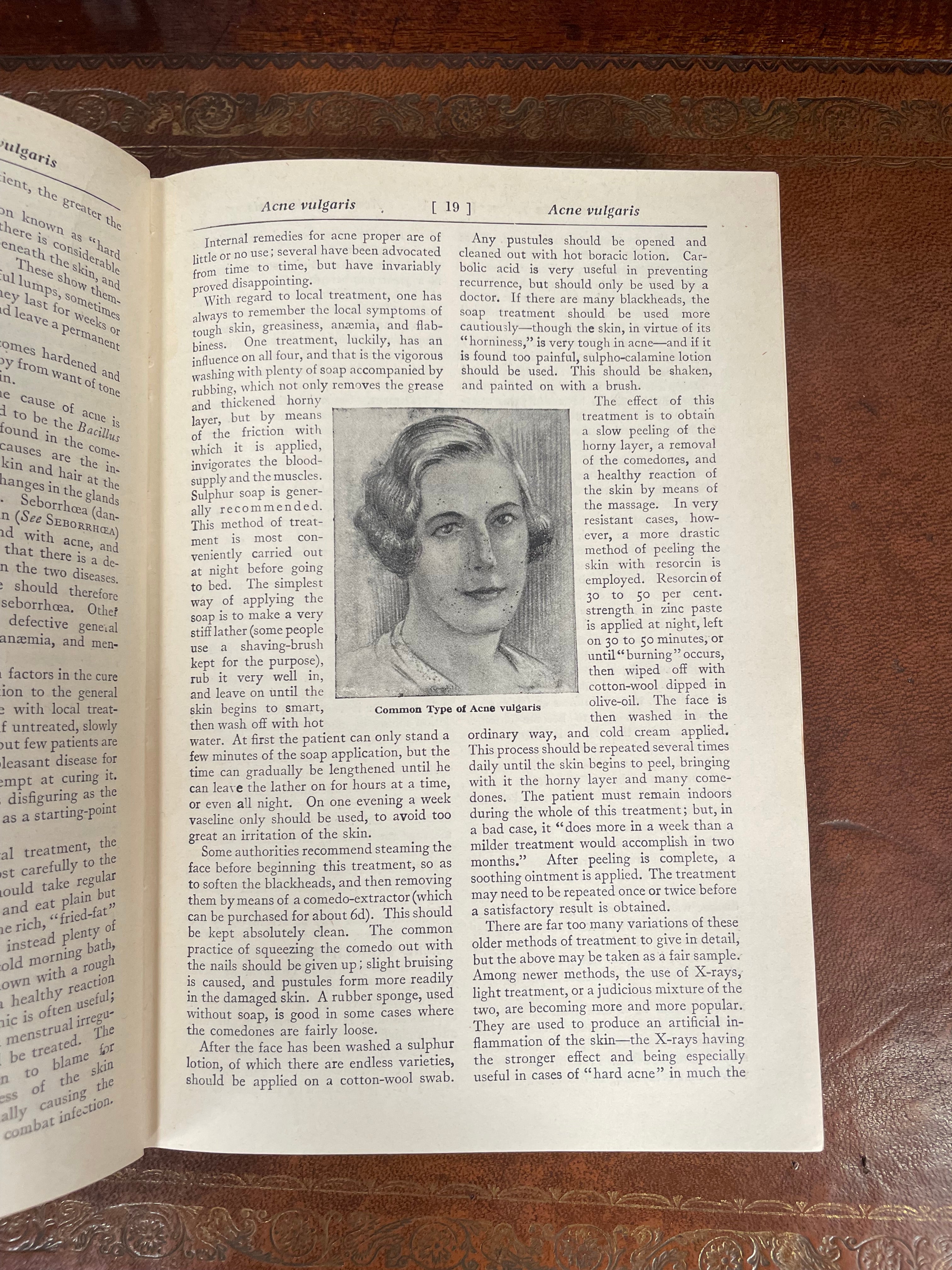 "The Universal Home Doctor Book" | Antique & Vintage | Moonee Ponds Antiques | Australia Wide Delivery
